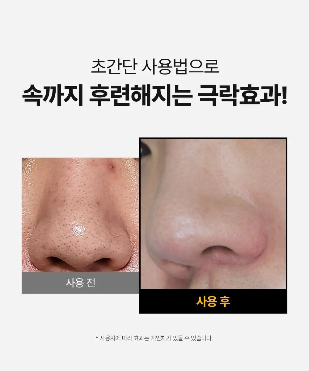 [피지케어/블랙헤드] 성분에디터 블랙헤드 멜팅 클리어 패드 30매 상세페이지 7